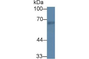 Western Blot; Sample: Rat Lung lysate; Primary Ab: 1µg/ml Rabbit Anti-Rat RTKN Antibody Second Ab: 0. (Rhotekin anticorps  (AA 296-548))