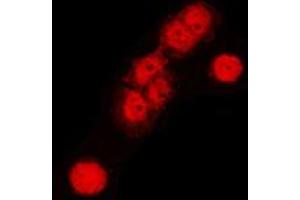 Immunofluorescent analysis of Cullin 1 staining in HeLa cells.