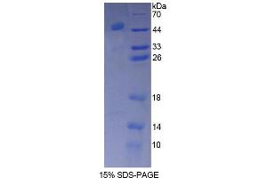 SDS-PAGE analysis of Rat Btk Protein. (BTK Protéine)