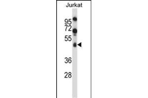 SPN/CD43 Antibody (Center) (ABIN658006 and ABIN2846949) western blot analysis in Jurkat cell line lysates (35 μg/lane). (CD43 anticorps  (AA 230-257))