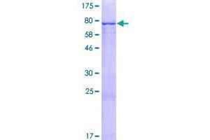 Image no. 1 for Coiled-Coil Domain Containing 11 (CCDC11) (AA 1-399) protein (GST tag) (ABIN1348246)
