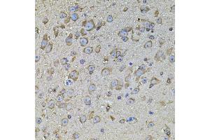 Immunohistochemistry of paraffin-embedded mouse brain using CPOX antibody. (CPOX anticorps)