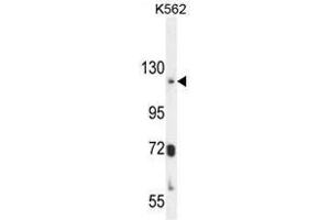 ATP8A2 Antibody (N-term) western blot analysis in K562 cell line lysates (35µg/lane). (ATP8A2 anticorps  (N-Term))