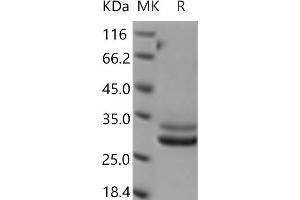 Western Blotting (WB) image for F11 Receptor (F11R) protein (His tag) (ABIN7321177) (F11R Protein (His tag))