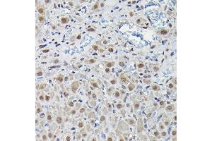 Immunohistochemistry of paraffin-embedded rat ovary using PFKFB3 Rabbit pAb (ABIN6129841, ABIN6145485, ABIN6145487 and ABIN6222692) at dilution of 1:25 (40x lens).