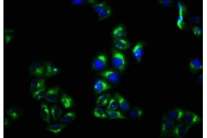 Immunofluorescence staining of Hela cells with ABIN7159461 at 1:100, counter-stained with DAPI. (CNNM4 anticorps  (AA 589-691))
