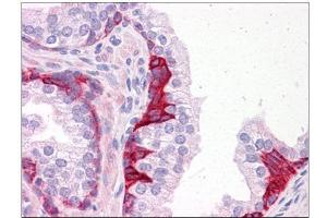 Human Prostate: Formalin-Fixed, Paraffin-Embedded (FFPE)
