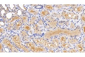 Detection of MAPK14 in Human Kidney Tissue using Polyclonal Antibody to Mitogen Activated Protein Kinase 14 (MAPK14)