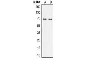 Western blot analysis of Nephrocystin 5 expression in Ramos (A), HeLa (B) whole cell lysates. (IQCB1 anticorps  (Center))