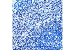 Immunohistochemistry of paraffin-embedded rat spleen using M/M/ML1 Rabbit mAb (ABIN7268354) at dilution of 1:100 (40x lens). (MAD2L1 anticorps)