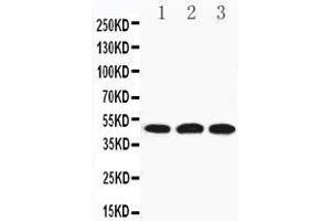 Anti-HYAL3 antibody, Western blotting Lane 1: 22RV Cell Lysate Lane 2: HELA Cell Lysate Lane 3: V20S Cell Lysate (HYAL3 anticorps  (C-Term))