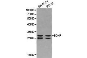 Western Blotting (WB) image for anti-Brain-Derived Neurotrophic Factor (BDNF) antibody (ABIN1871274) (BDNF anticorps)