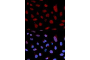 Immunofluorescence analysis of U2OS cells using TNNC1 antibody. (TNNC1 anticorps)