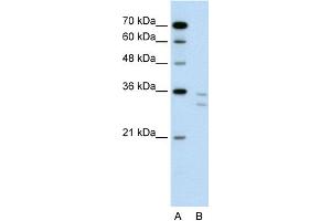 WB Suggested Anti-CD8B Antibody Titration:  0. (CD8B anticorps  (N-Term))