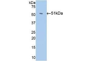 Detection of Recombinant Antithrombin, Human using Monoclonal Antibody to Antithrombin (AT)