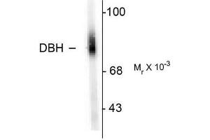 Image no. 1 for anti-Dopamine beta-Hydroxylase (Dopamine beta-Monooxygenase) (DBH) (N-Term) antibody (ABIN372612) (DBH anticorps  (N-Term))