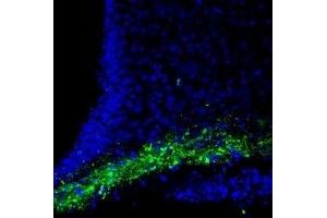 Expression of CASK in rat hypothalamus - Immunohistochemical staining of rat hypothalamus free floating frozen sections using Anti-CASK Antibody (ABIN7043020, ABIN7044534 and ABIN7044535), (1:200).