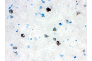 Anti- VCP Picoband antibody, IHC(F) IHC(F): Rat Brain Tissue