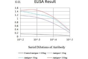 Black line: Control Antigen (100 ng),Purple line: Antigen (10 ng), Blue line: Antigen (50 ng), Red line:Antigen (100 ng)