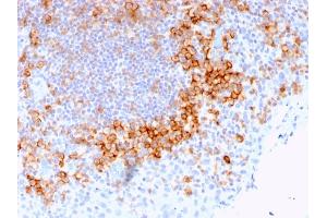 Formalin-fixed, paraffin-embedded human Tonsil stained with CD27 Mouse Monoclonal Antibody (LPFS2/1611).