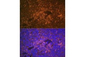 Immunohistochemistry of paraffin-embedded human esophagus using S100 Rabbit pAb (ABIN6129321, ABIN6147336, ABIN6147338 and ABIN6220958) at dilution of 1:350 (40x lens). (S100A12 anticorps  (AA 1-92))