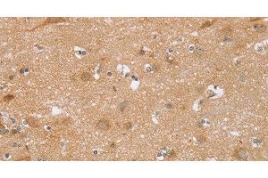 Immunohistochemistry of paraffin-embedded Human brain using TRIM34 Polyclonal Antibody at dilution of 1:30 (TRIM34 anticorps)