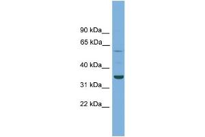 WB Suggested Anti-C3orf67 Antibody Titration: 0. (C3orf67 anticorps  (N-Term))