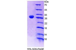 SDS-PAGE analysis of Human SRSF1 Protein. (SRSF1 Protéine)