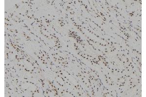 ABIN6265843 and ABIN6277620 at 1/100 staining Human kidney tissue by IHC-P.