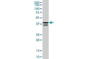 PCBP2 monoclonal antibody (M05), clone 1C7. (PCBP2 anticorps  (AA 1-362))