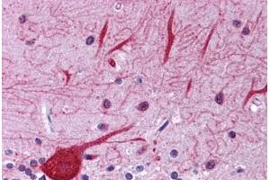 anti-Eukaryotic Translation Initiation Factor 2-alpha Kinase 1 (EIF2AK1) (AA 108-157) antibody