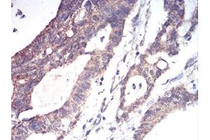 Immunohistochemistry (IHC) image for anti-Aldehyde Dehydrogenase 6 Family, Member A1 (ALDH6A1) (AA 1-195) antibody (ABIN5856297) (ALDH6A1 anticorps  (AA 1-195))