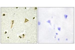 Immunohistochemistry (IHC) image for anti-TSC22 Domain Family, Member 1 (TSC22D1) (N-Term) antibody (ABIN1849646) (TSC22D1 anticorps  (N-Term))