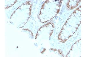 Formalin-fixed, paraffin-embedded human Colon stained with CDX2 Mouse Monoclonal Antibody (rCDX2/1690).