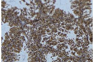 ABIN6276429 at 1/100 staining Mouse testis tissue by IHC-P.