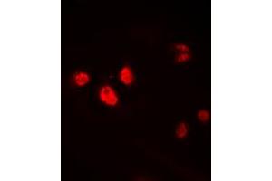 Immunofluorescent analysis of HEN1/2 staining in HEK293T cells. (HEN1/2 (Center) anticorps)