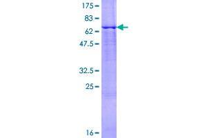 Image no. 1 for BCS1-Like (BCS1L) (AA 1-419) protein (GST tag) (ABIN7199684)