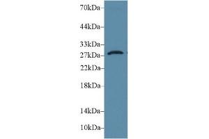 Detection of DIO3 in Rat Placenta lysate using Polyclonal Antibody to Deiodinase, Iodothyronine, Type III (DIO3)