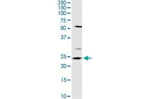 OTUB2 MaxPab rabbit polyclonal antibody.