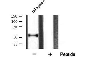 Western blot analysis of p53 phosphorylation expression in rat spleen lysates,The lane on the right is treated with the antigen-specific peptide.