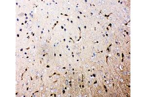 IHC-P: Aquaporin 4 antibody testing of rat brain tissue.