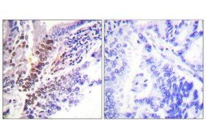 anti-GR (Internal Region), (pSer226), (pSer234), (pSer246) antibody