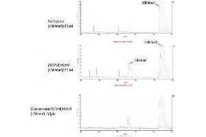 JARID1B / KDM5B activity assay.