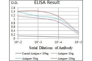 Black line: Control Antigen (100 ng), Purple line: Antigen(10 ng), Blue line: Antigen (50 ng), Red line: Antigen (100 ng), (Cadherin-16 anticorps)
