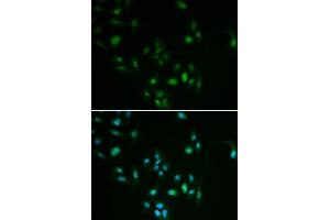 Immunofluorescence analysis of MCF7 cell using BCL2 antibody. (Bcl-2 anticorps  (AA 81-131))