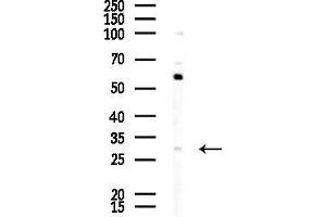 anti-Gap Junction Protein, beta 5, 31,1kDa (GJB5) (C-Term) antibody