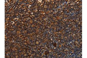 anti-Uroplakin 3B (UPK3B) antibody