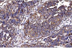 IHC analysis of HGS using anti-HGS antibody (ABIN7601206).