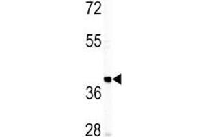Western blot analysis of IGHM antibody and T47D lysate. (IGHM anticorps  (AA 103-131))