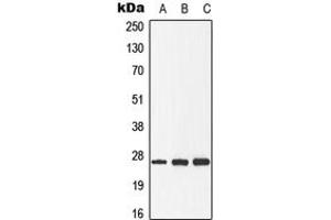 Western blot analysis of GADD153 (pS30) expression in HeLa (A), Raw264.